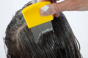 Treating a child for head lice using a fine-tooth head lice comb